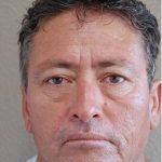 Blepharoplasty Before & After Patient #1354
