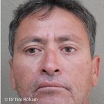 Blepharoplasty Before & After Patient #1354