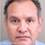 Blepharoplasty Before & After Patient #1360