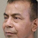 Blepharoplasty Before & After Patient #1367