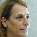 Blepharoplasty Before & After Patient #1368