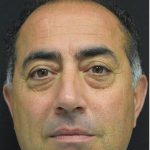 Blepharoplasty Before & After Patient #1372