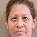 Blepharoplasty Before & After Patient #1347