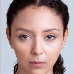 Xeomin Before & After Patient #1539