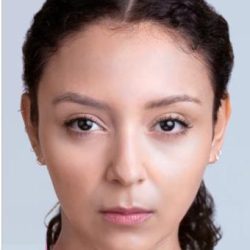 Xeomin Before & After Patient #1539